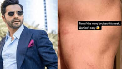Varun Dhawan Showcases ‘Few of the Many Bruises’ He Sustained