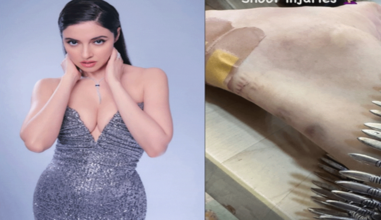 Divya Khossla Sustains Injury on Set While Filming Her Upcoming Movie