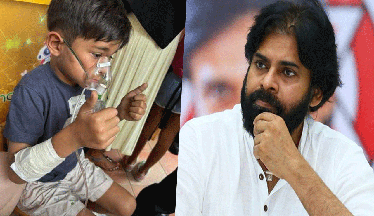 Pawan Kalyan's Son Health Update: Mark Shankar Recovering Well After Singapore Fire Incident