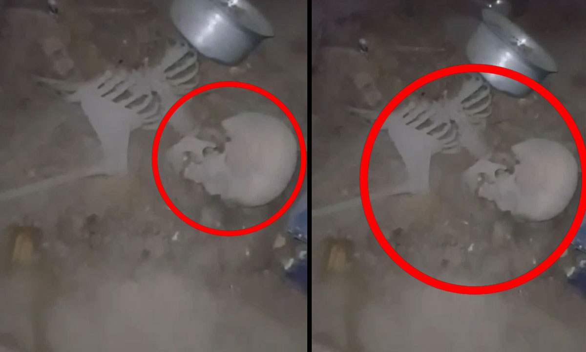 Nampally House Horror: Skeletal Remains Believed to Be of Missing Man, No Complaint Filed by Family