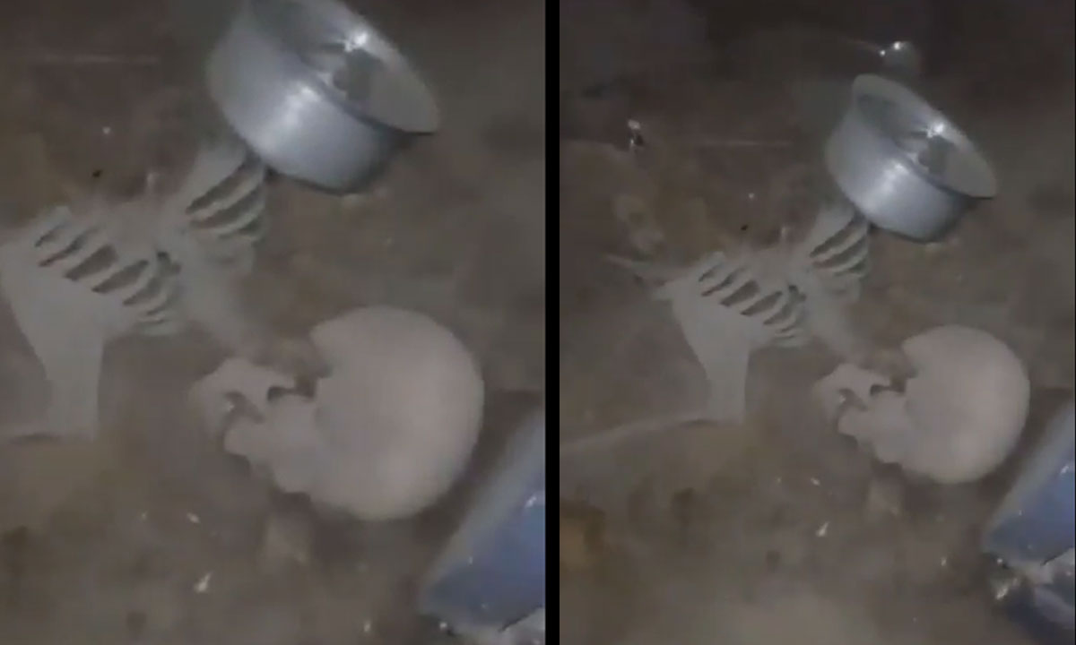 Nampally Human Skeleton Mystery Solved: Nokia Phone with 84 Missed Calls Unravels Identity