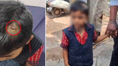 LKG Student Injured After Teacher Hits Him with Tiffin Box in Saeedabad School